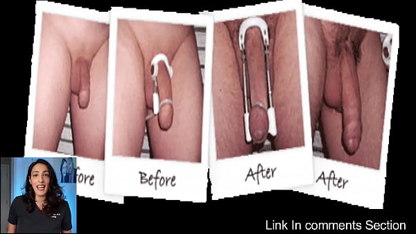 Scientifically proven ways to increase penile length